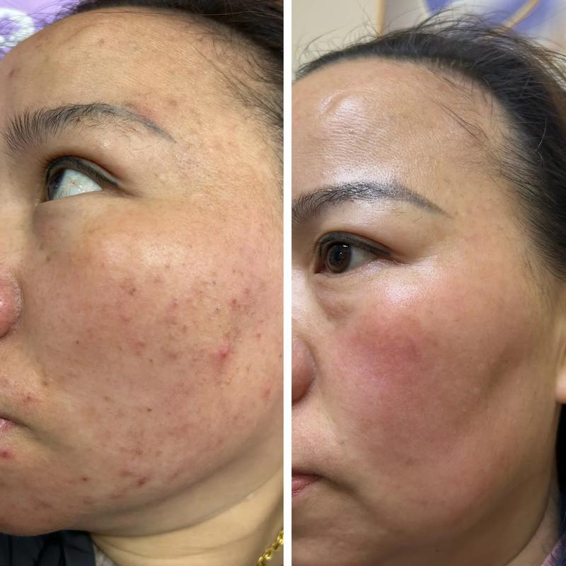 透视美容行业的未来趋势——博横美容院的崛起