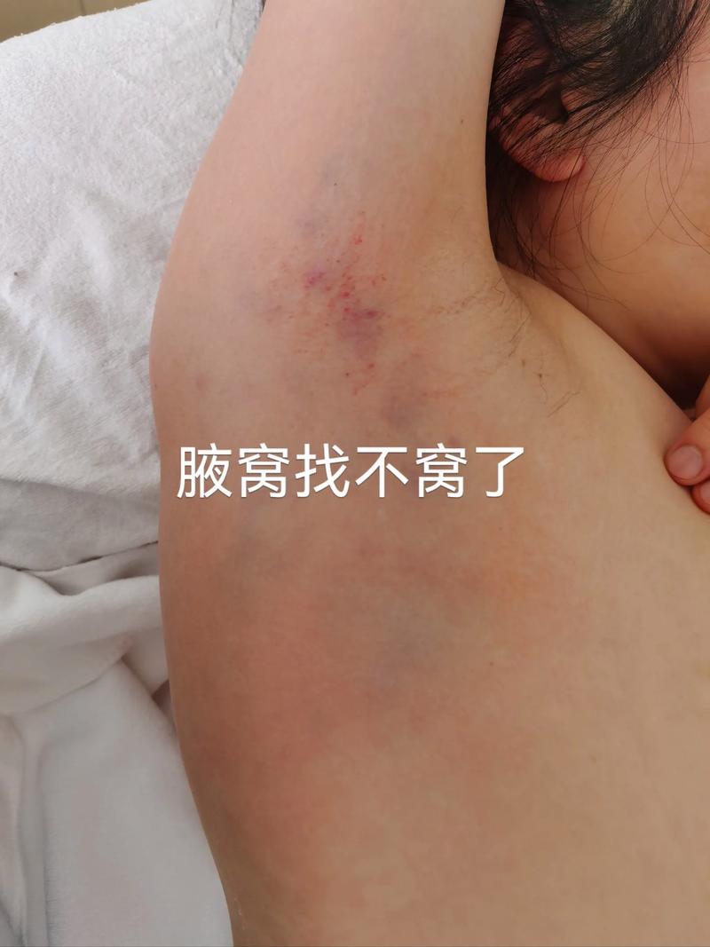 北林区美容院：引领美丽新潮流