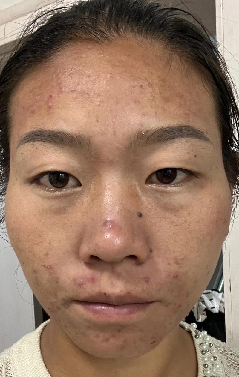 面部护理：科技与自然的完美融合