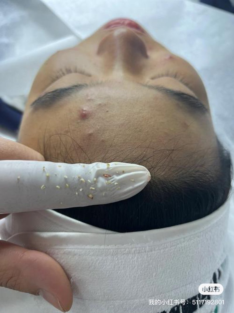北林区美容院：都市女性的美丽秘籍
